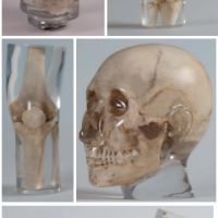 天然骨骼X-Ray训练模体