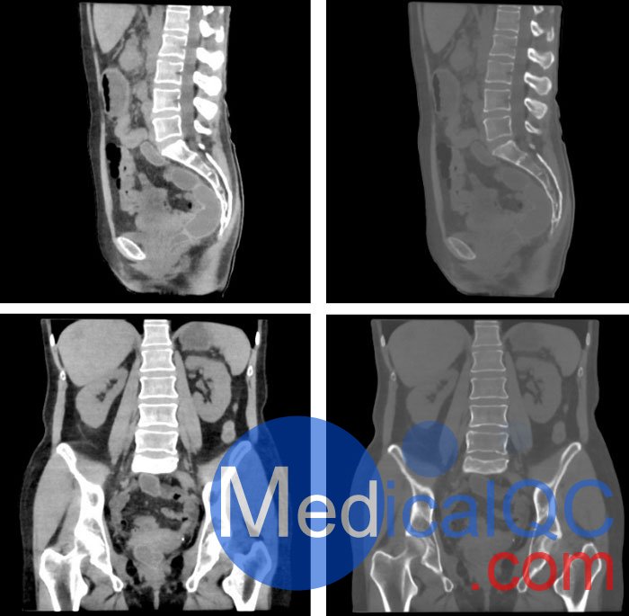 WEK55-02腹部骨盆模体，WEK55-02腹部骨盆模型