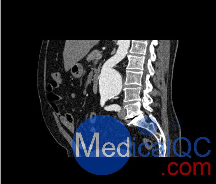 WEK53-05腹部模体，WEK53-05动脉瘤腹部模体