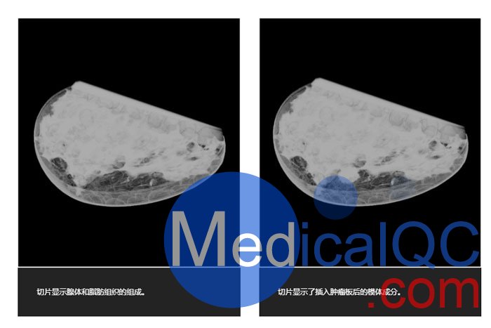 WEK59-01乳腺模体,WEK59-01乳房模型