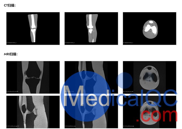 KE-A03成人膝关节，KE-A03膝关节模体,KE-A03膝关节模型成像效果图