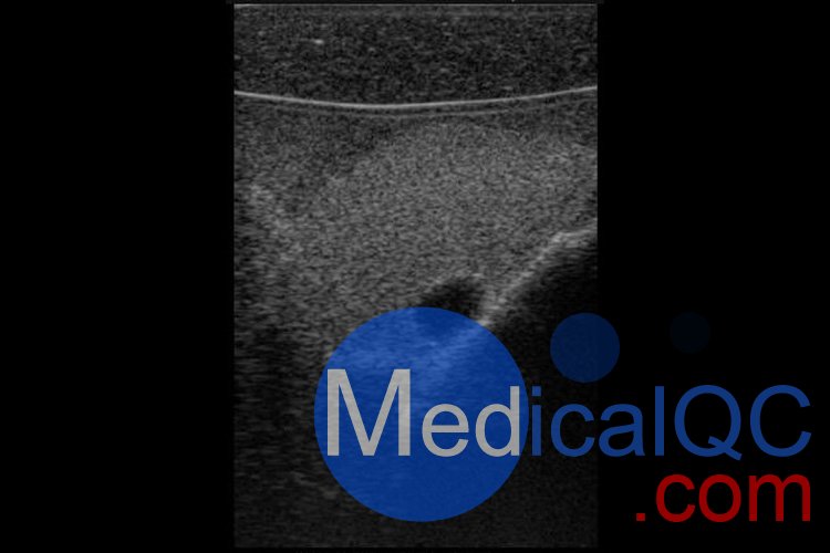 Cirs074甲状腺超声训练模体,Cirs074甲状腺穿刺模体超声成像图